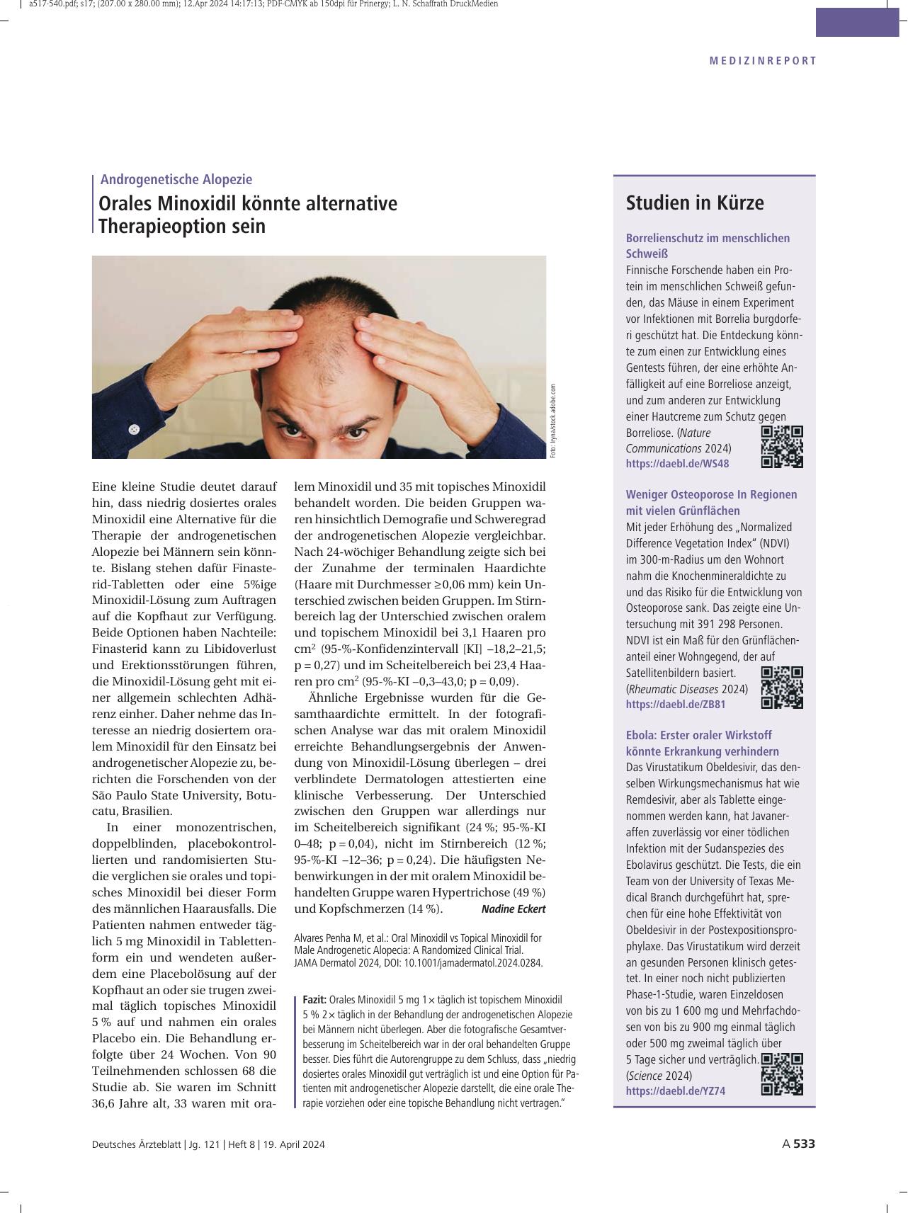 Vorschauseite 1: Androgenetische Alopezie: Orales Minoxidil könnte alternative Therapieoption sein.