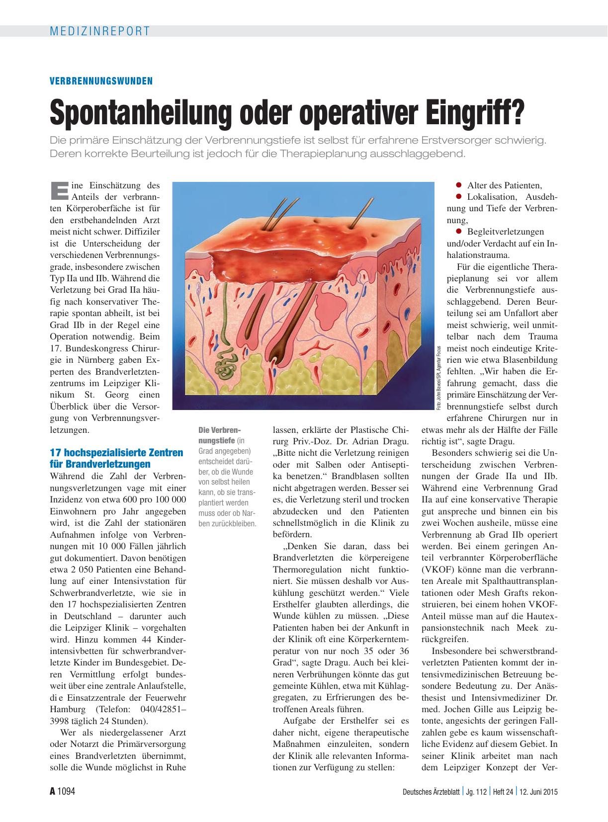 Vorschauseite 1: Verbrennungswunden: Spontanheilung oder operativer Eingriff?
