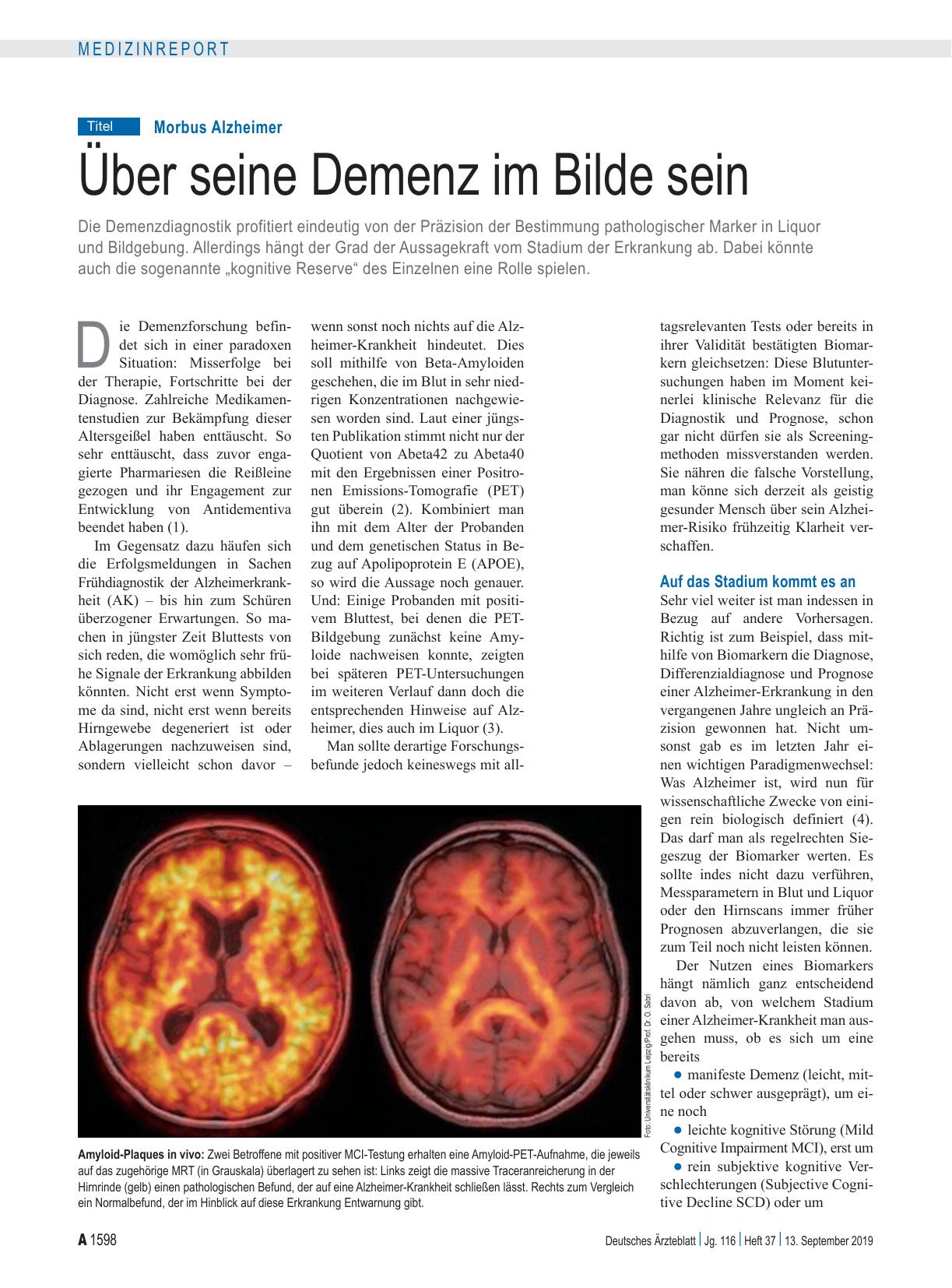 Vorschauseite 1: Morbus Alzheimer: Über seine Demenz im Bilde sein