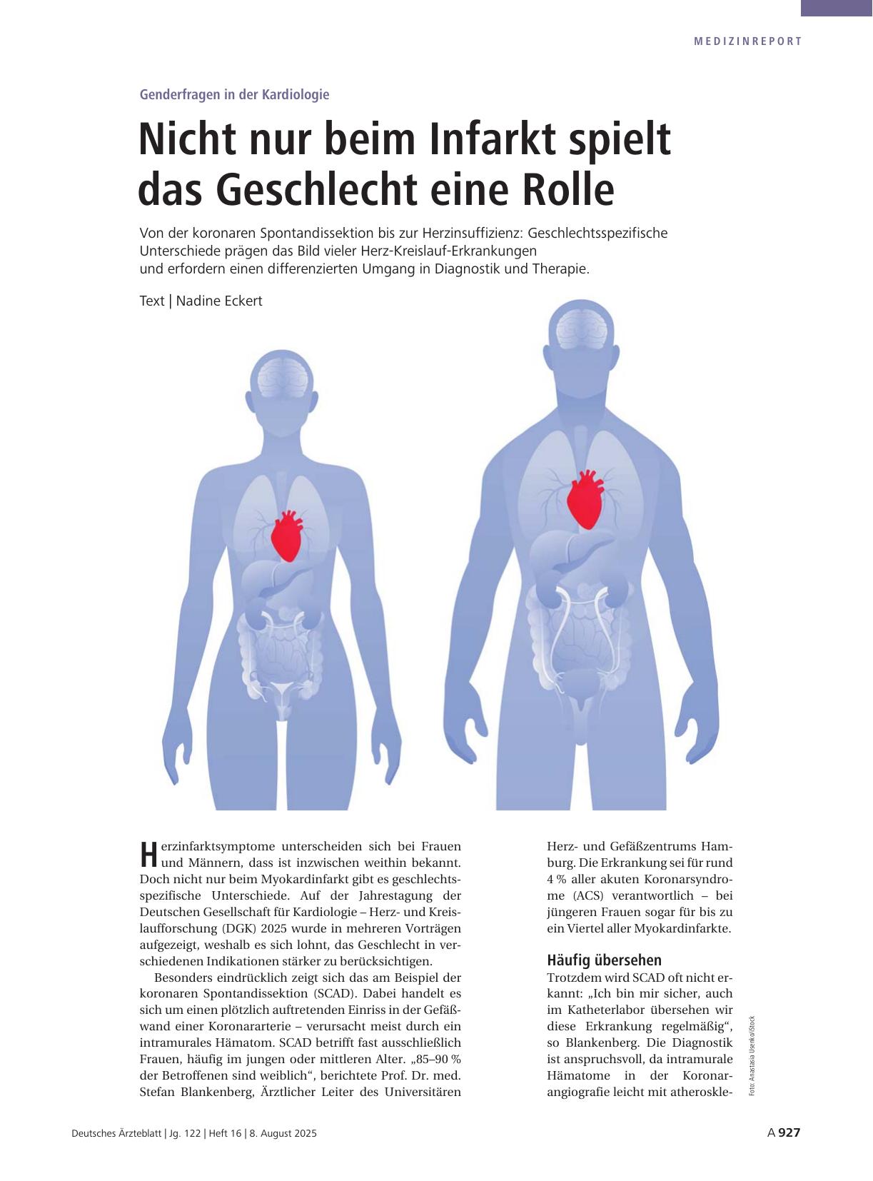 Vorschauseite 1: Genderfragen in der Kardiologie: Nicht nur beim Infarkt spielt das Geschlecht eine Rolle