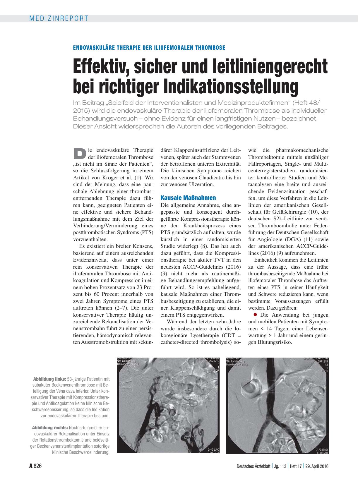 Vorschauseite 1: Endovaskuläre Therapie der iliofemoralen Thrombose: Effektiv, sicher und leitliniengerecht bei richtiger Indikationsstellung