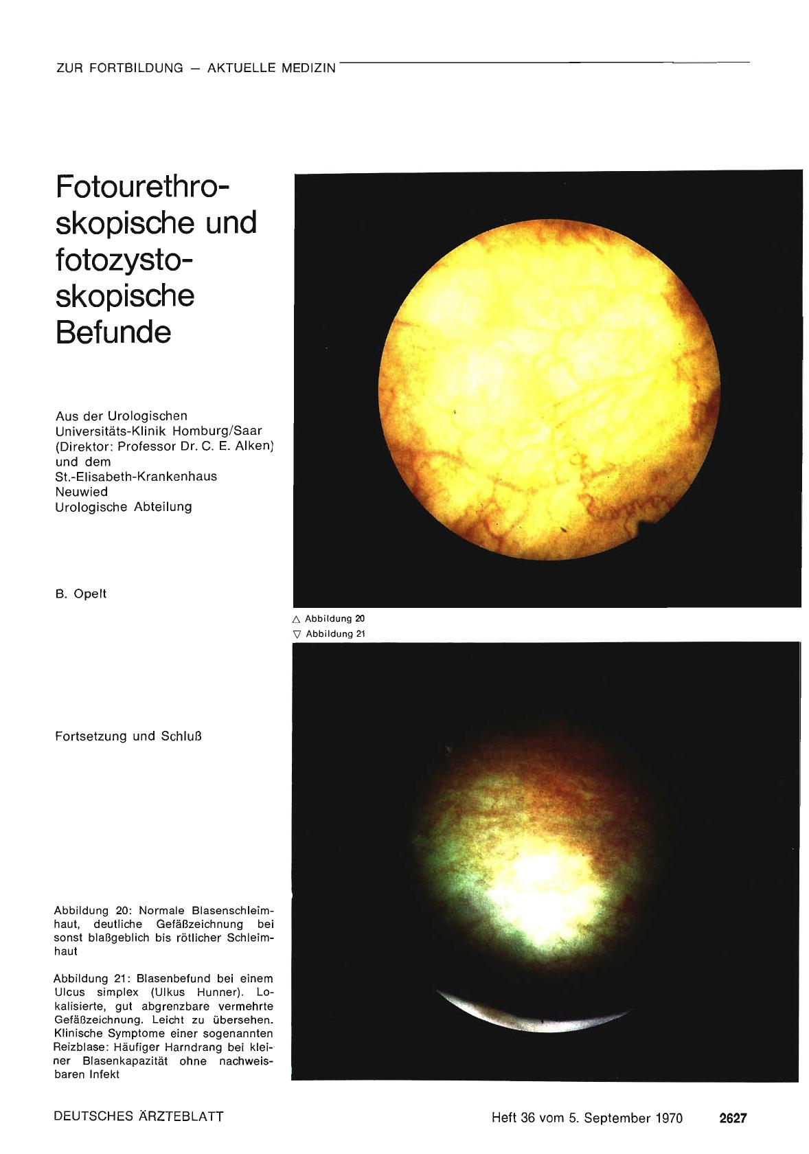 Vorschauseite 1: Fotourethroskopische und fotozystoskopische Befunde (Fortsetzung und Schluß)