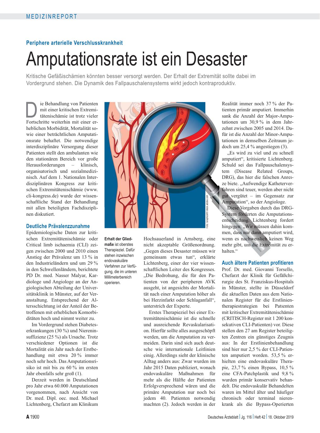 Vorschauseite 1: Periphere arterielle Verschlusskrankheit: Amputationsrate ist ein Desaster
