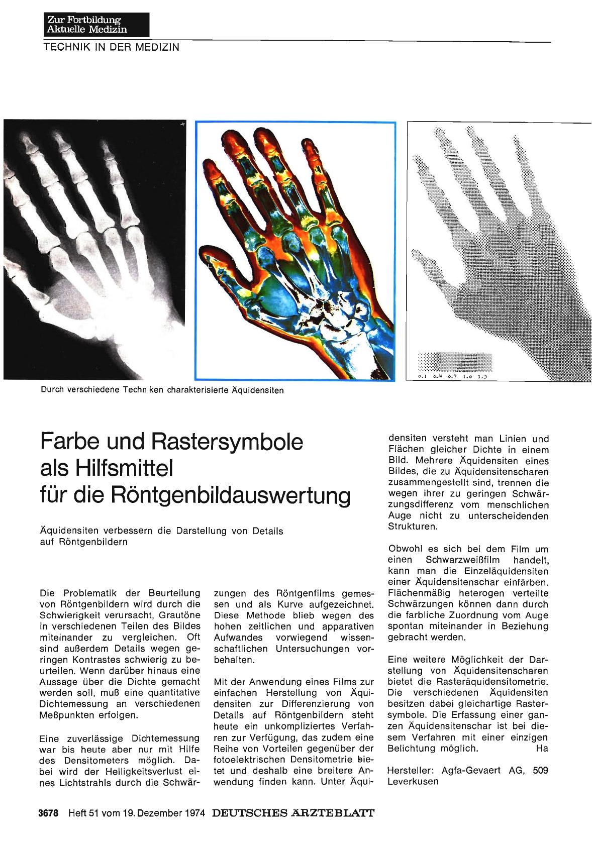 Vorschauseite 1: Farbe und Rastersymbole als Hilfsmittel für die Röntgenbildauswertung