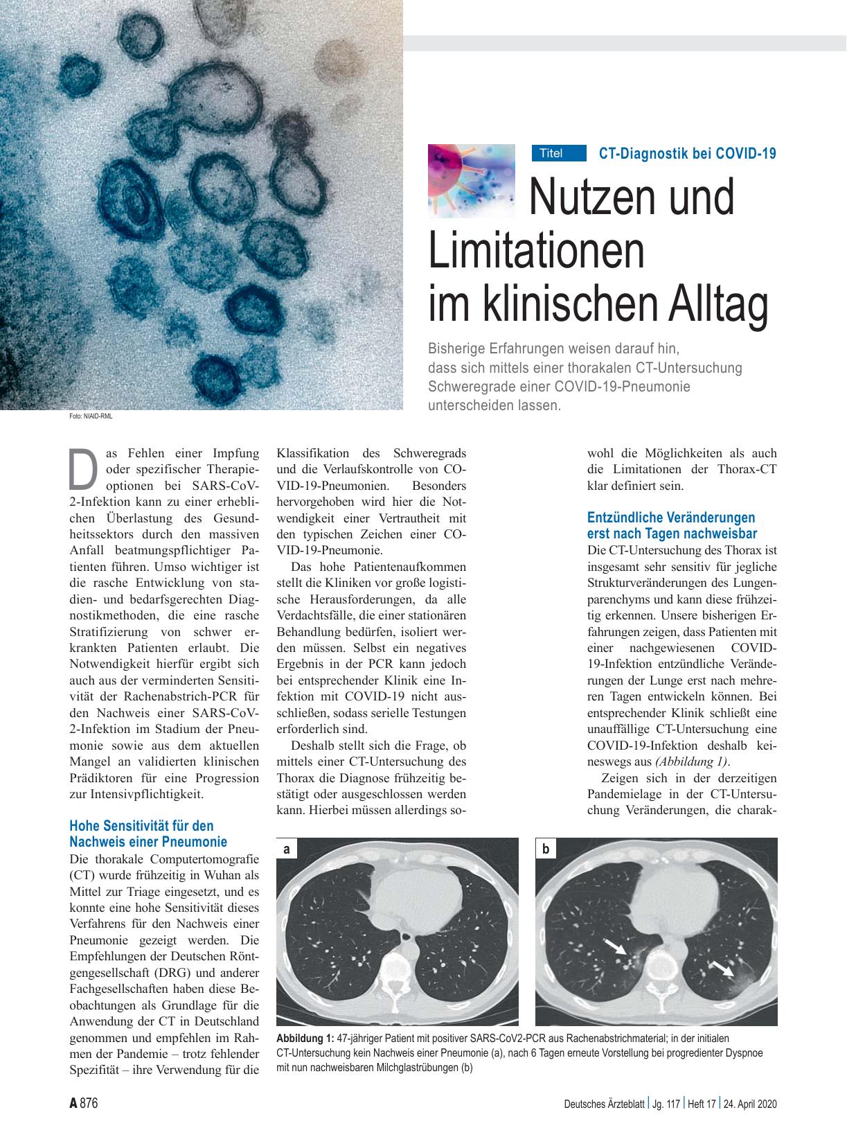 Vorschauseite 1: CT-Diagnostik bei COVID-19: Nutzen und Limitationen im klinischen Alltag