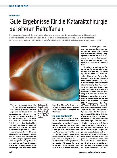 Vorschauseite 1: Grauer Star: Gute Ergebnisse für die Kataraktchirurgie bei älteren Betroffenen