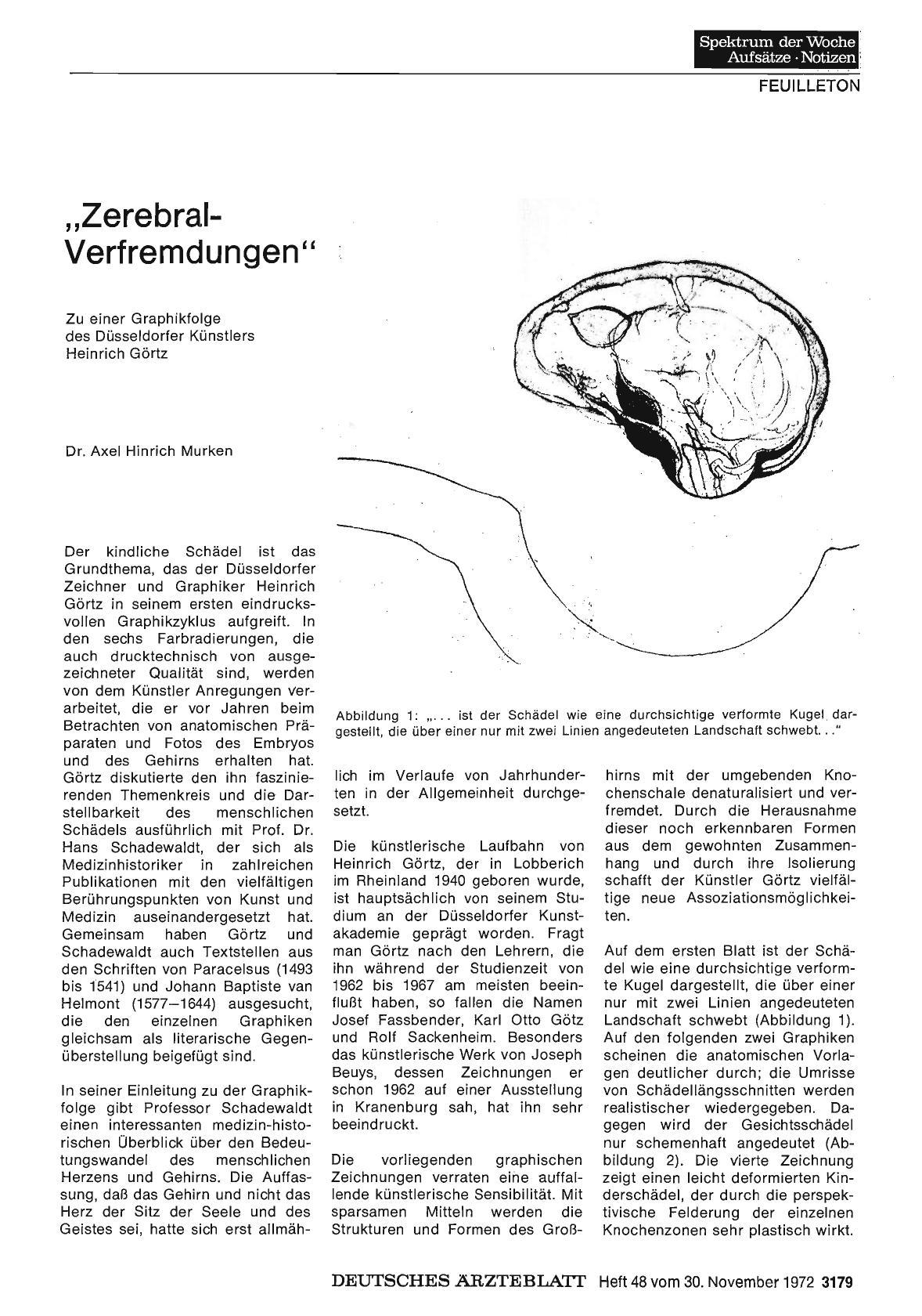 Vorschauseite 1: "Zerebral-Verfremdungen”
