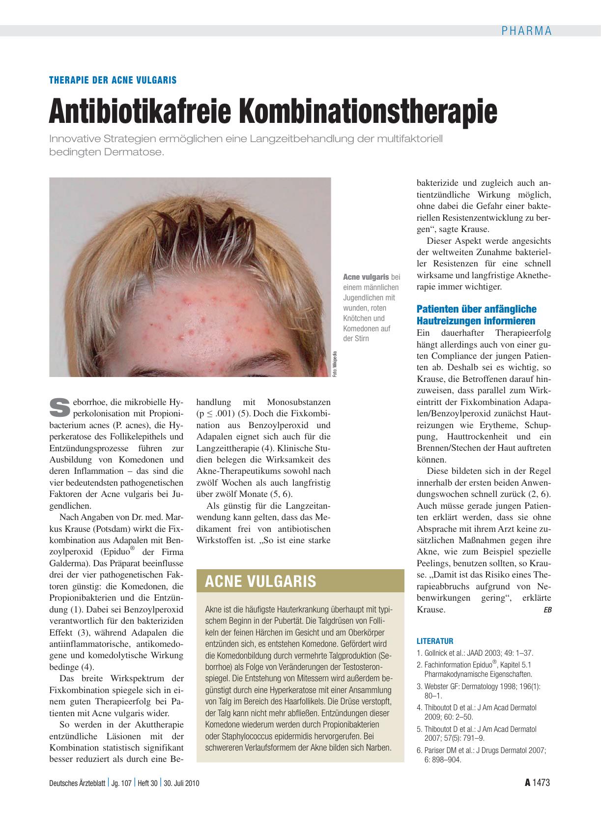 Vorschauseite 1: Therapie der Acne vulgaris: Antibiotikafreie Kombinationstherapie