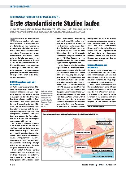 Vorschauseite 1: Hochintensiver fokussierter Ultraschall/HIFU (1): Erste standardisierte Studien laufen