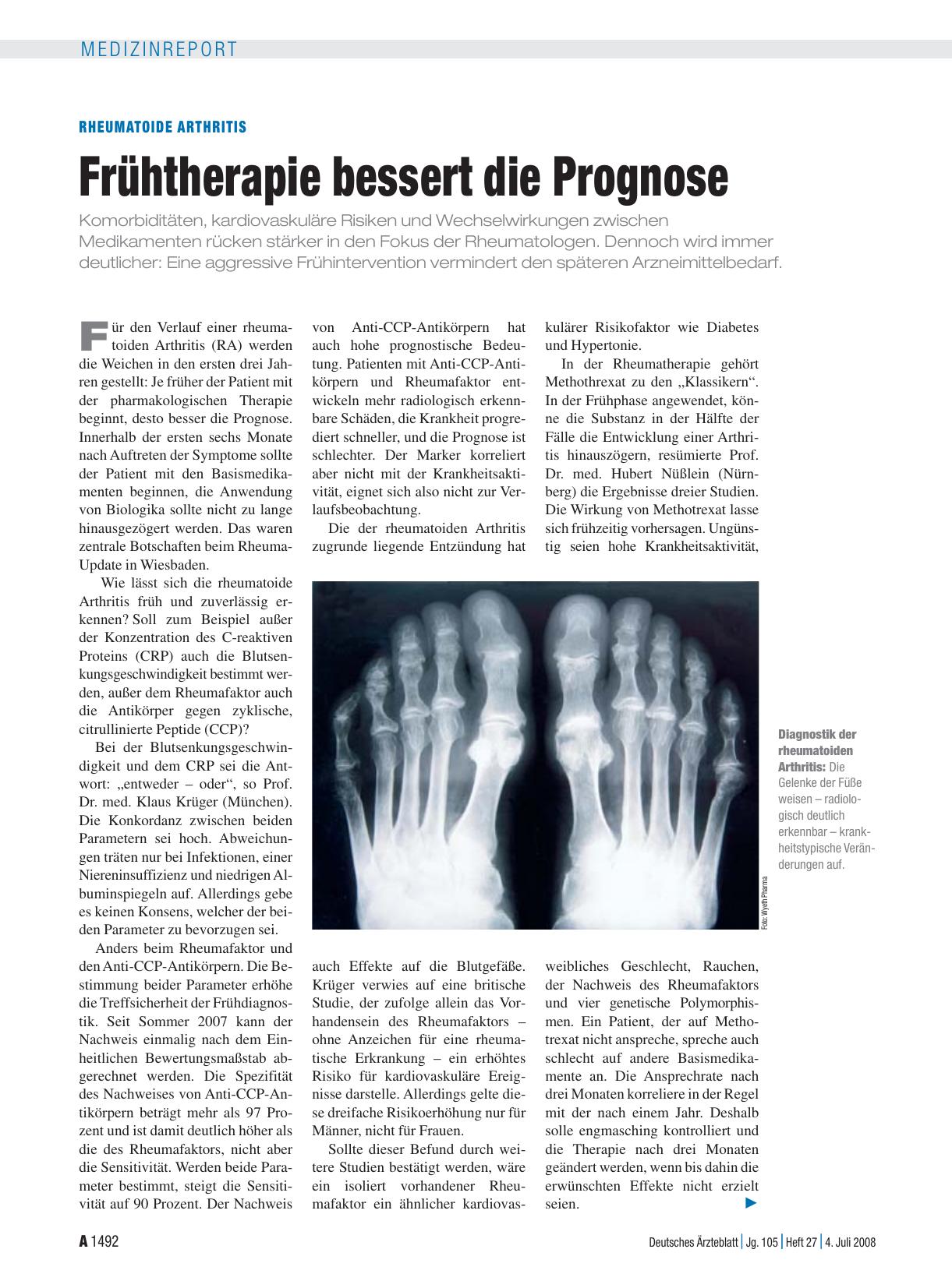 Vorschauseite 1: Rheumatoide Arthritis: Frühtherapie bessert die Prognose